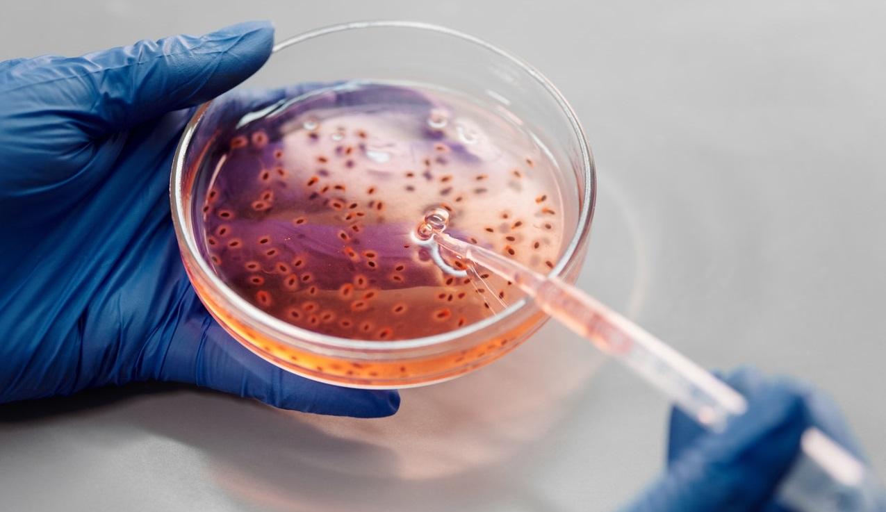 Translational Research Immuno- & Oncology Translational Research Immuno- & Oncology